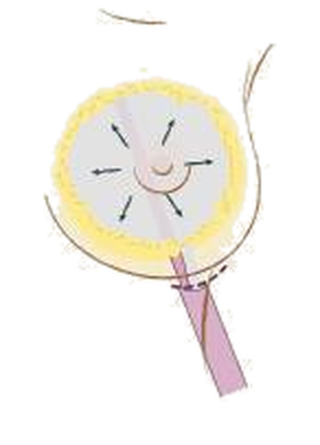 Illustration of the Motiva Inflatable Balloon creating the implant pocket